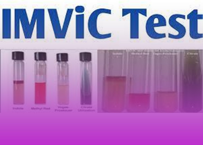 test imvic