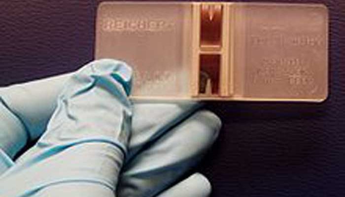 220px-Hemocytometer_with_gloved_hand