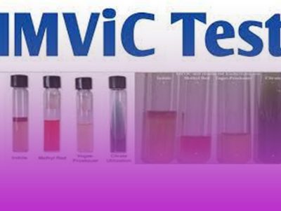 test imvic